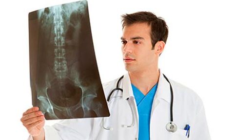 лекарят гледа рентгенова снимка, за да диагностицира болката в кръста