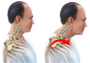 здрави и болки в гръбначния стълб